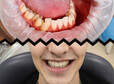thumb dental metamorfoza