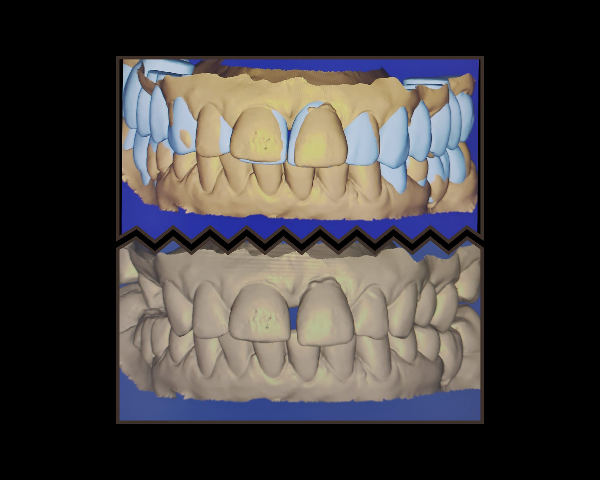 Nowoczesna stomatologia bez wycisków – poznaj cyfrową rewolucję w Dental Clinica!
